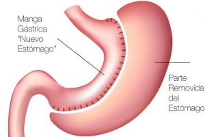 manga-gastrica